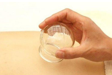 拔罐后罐印长时间不退怎么回事 瘀血严重需要半个月