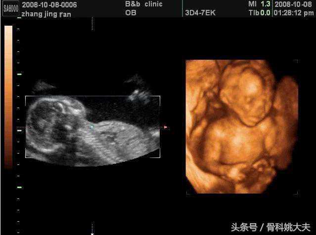 医院最常见检查-彩超，X线，CT，MRI到底怎么选？（干货收藏）